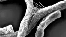 anthrax-bacillus-anthracis
