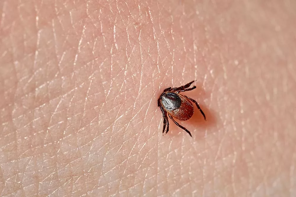 b9141.hr - Illustration Une tique sur 5 porteuse de la maladie de Lyme