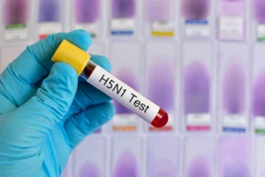 h5n1 test